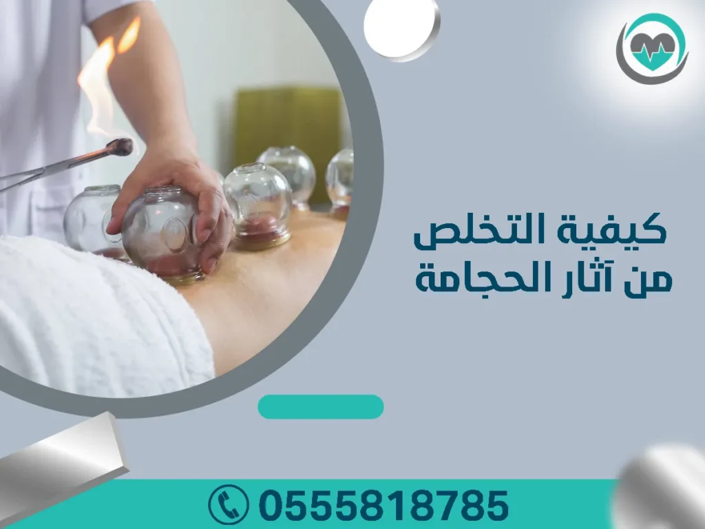 أهم مواضع الحجامة بالجسم