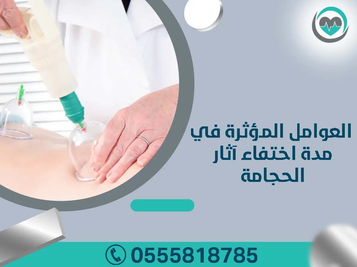 أهم مواضع الحجامة بالجسم