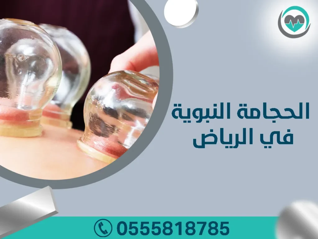 الحجامة النبوية في الرياض