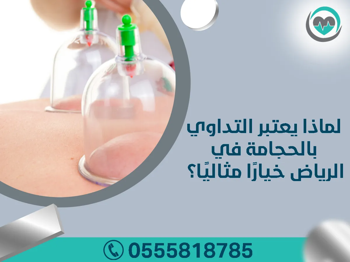 التداوي بالحجامة في الرياض