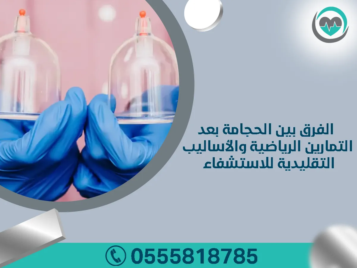 الحجامة بعد التمارين الرياضية