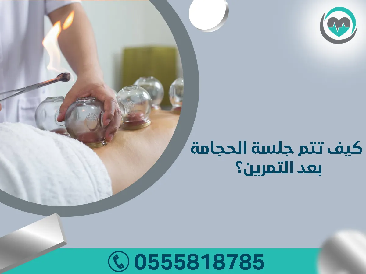 الحجامة بعد التمارين الرياضية