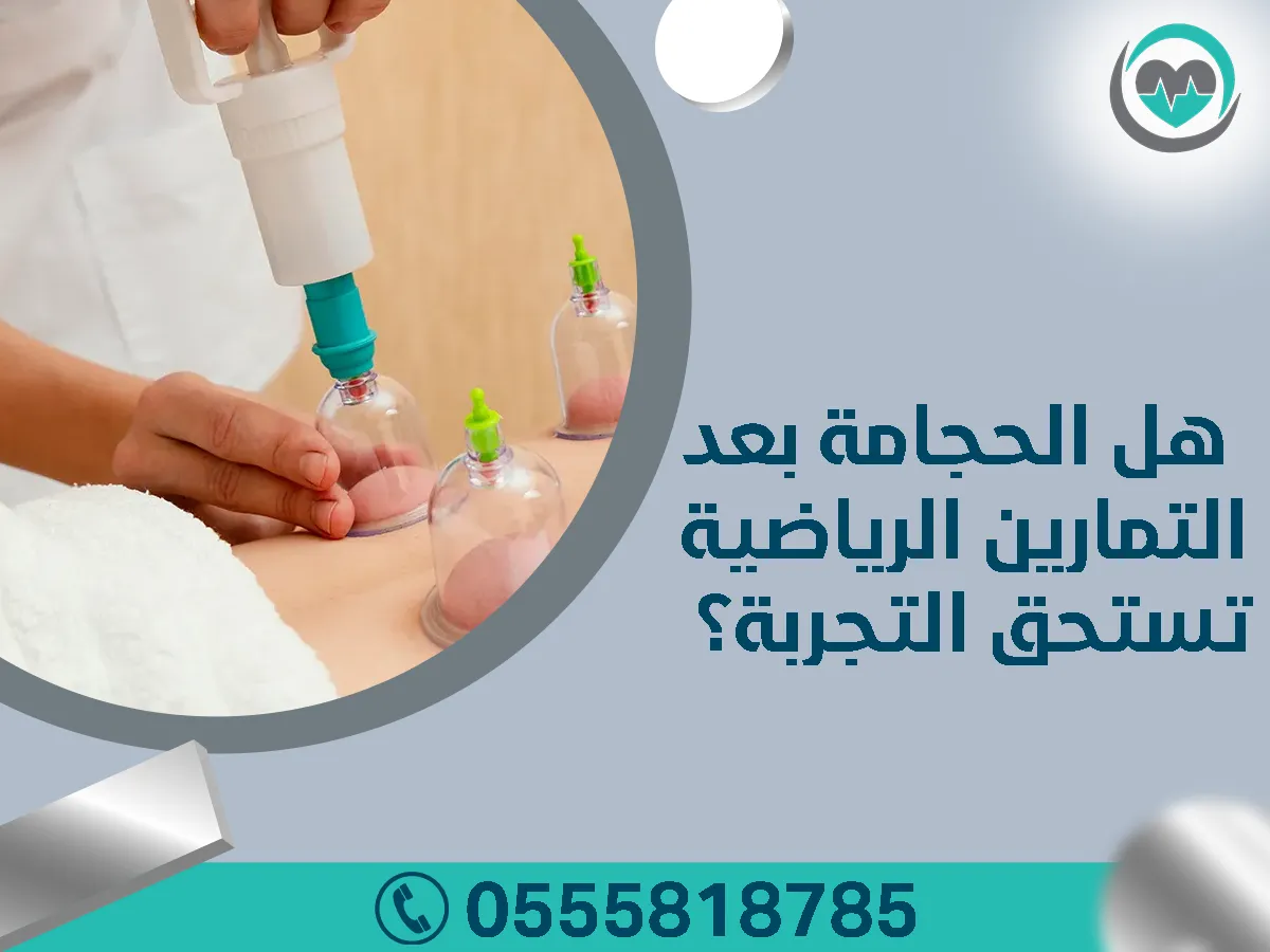 الحجامة بعد التمارين الرياضية