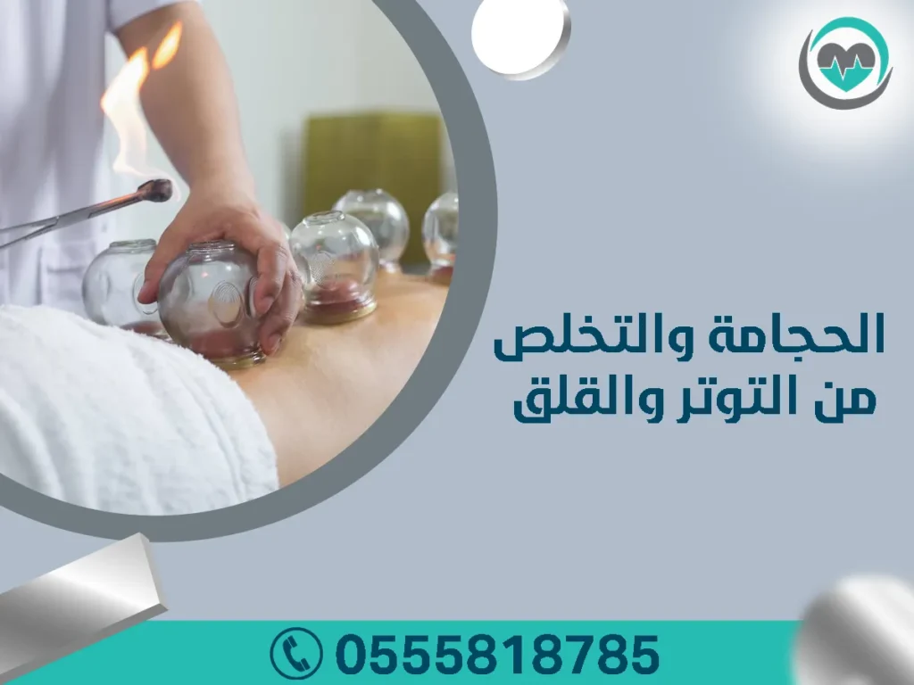 الحجامة والتخلص من التوتر والقلق