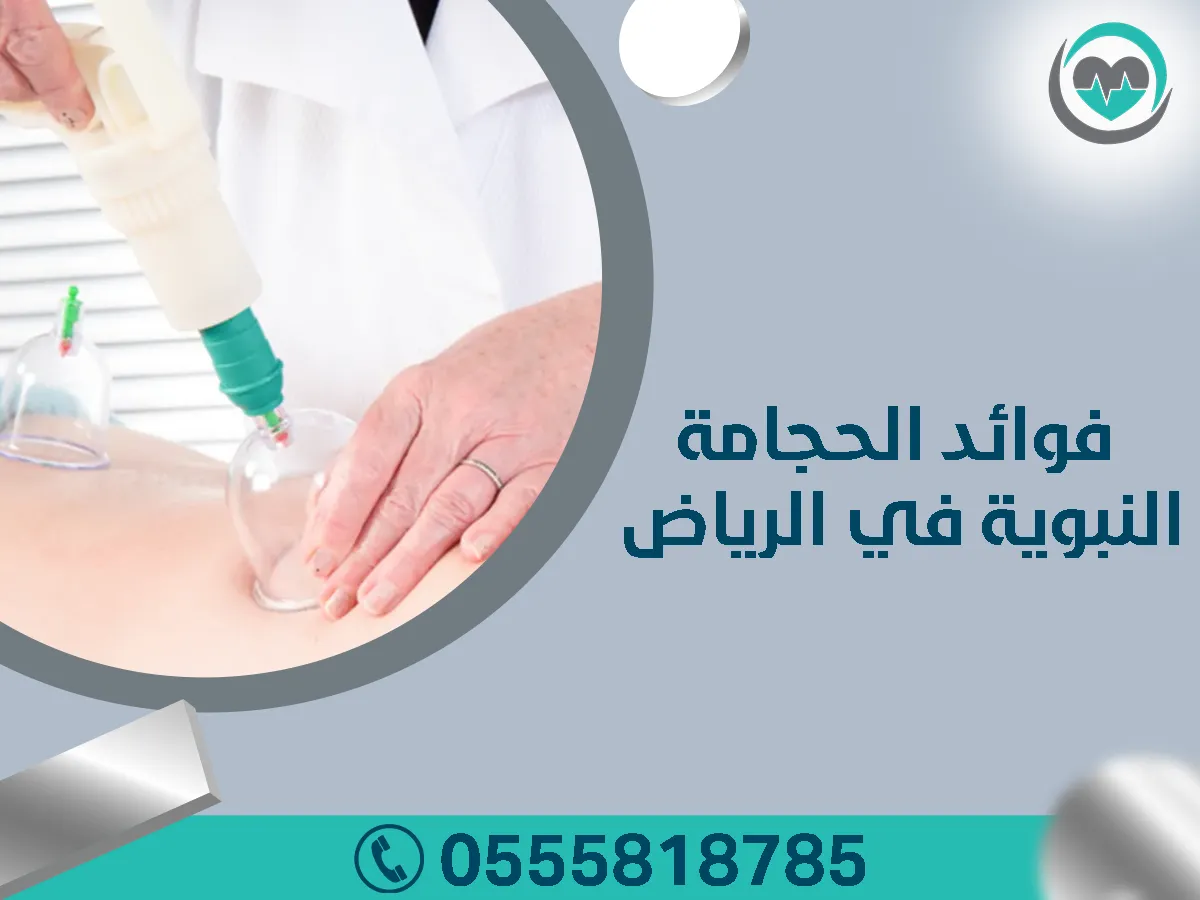 الحجامة النبوية في الرياض