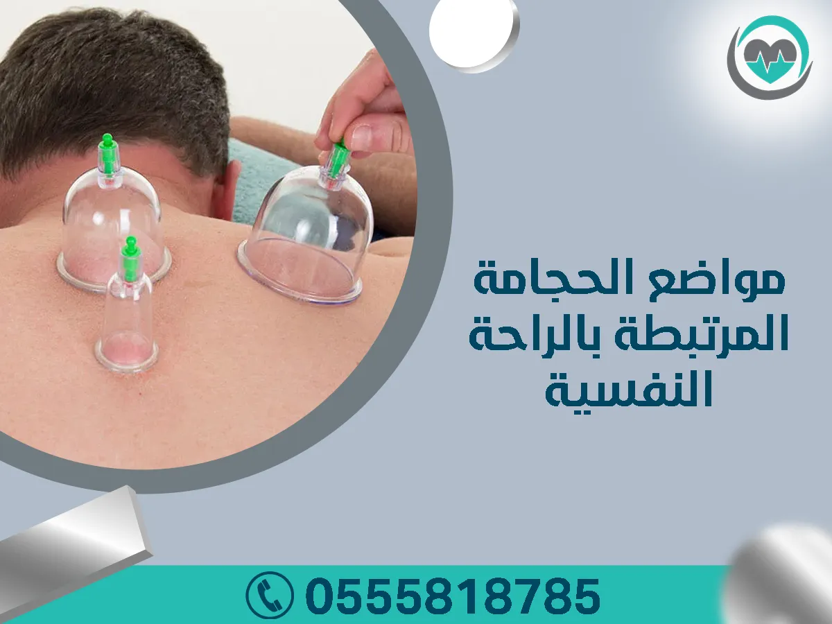 الحجامة والتخلص من التوتر والقلق