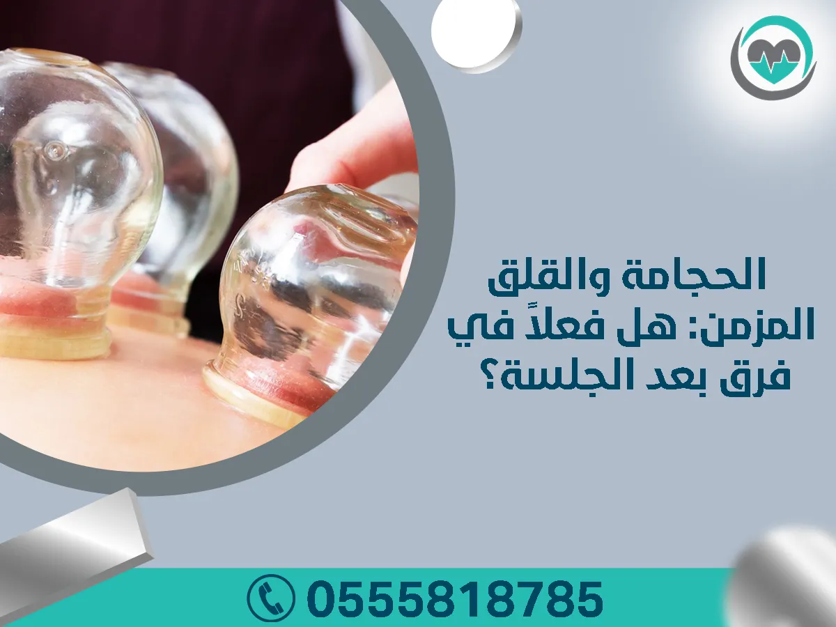 الحجامة والتخلص من التوتر والقلق