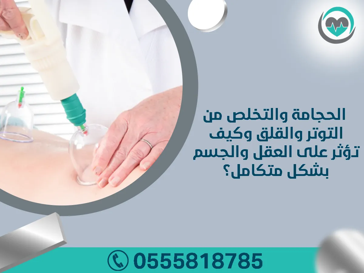 الحجامة والتخلص من التوتر والقلق
