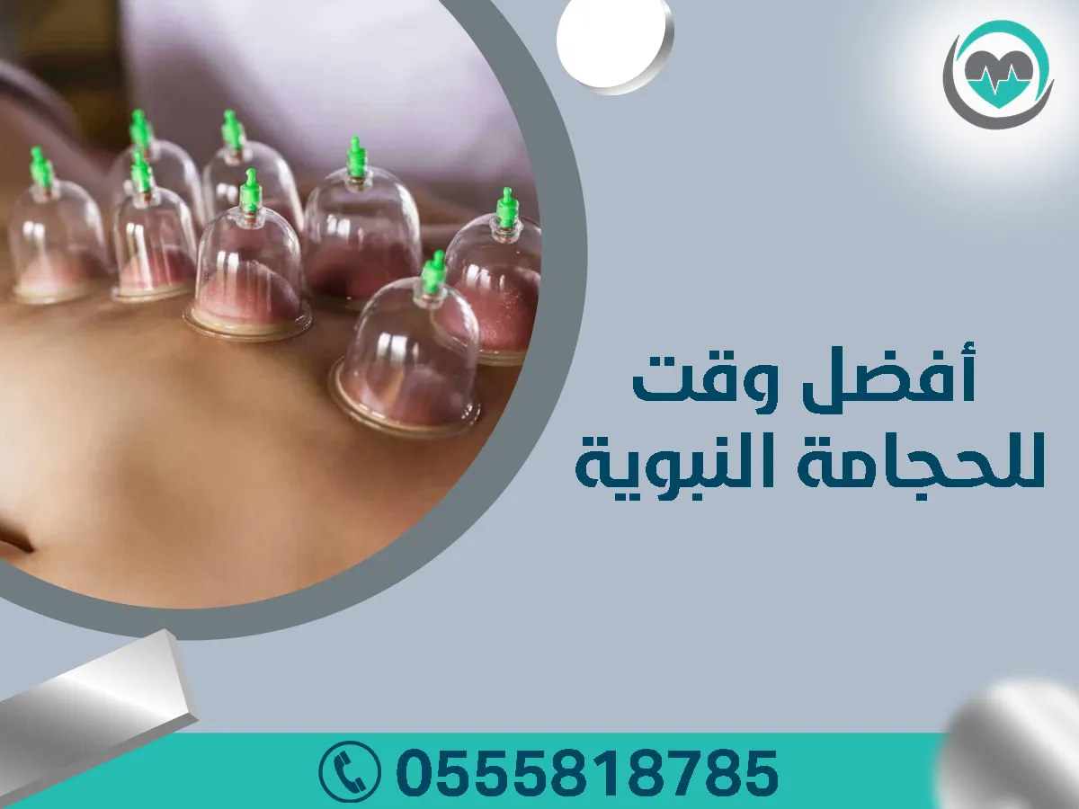 الحجامة النبوية في الرياض