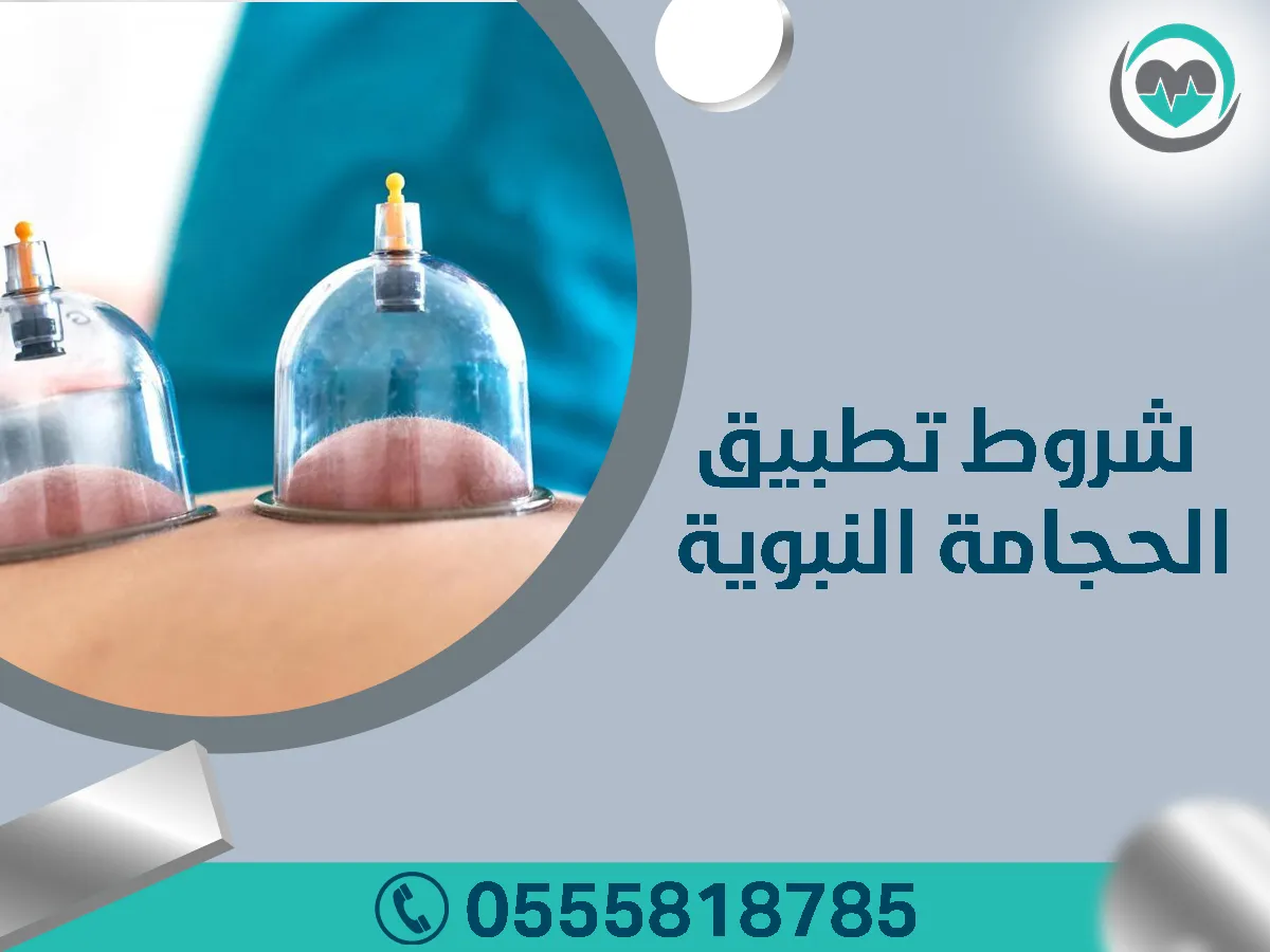 الحجامة النبوية في الرياض