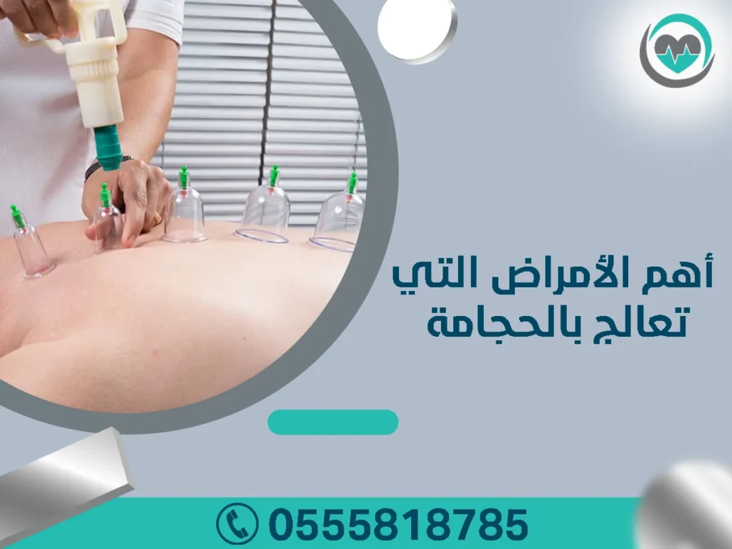 أهم الأمراض التي تعالج بالحجامة