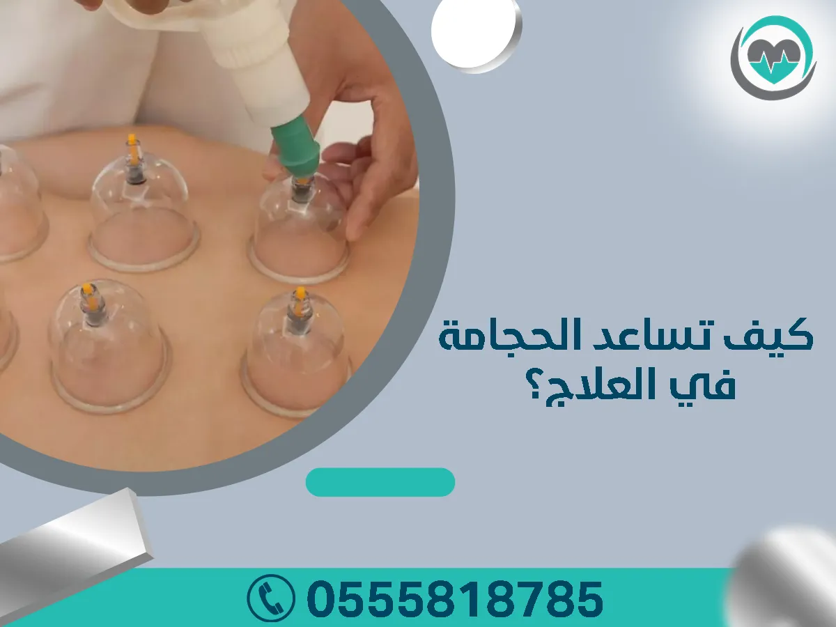 أهم الأمراض التي تعالج بالحجامة