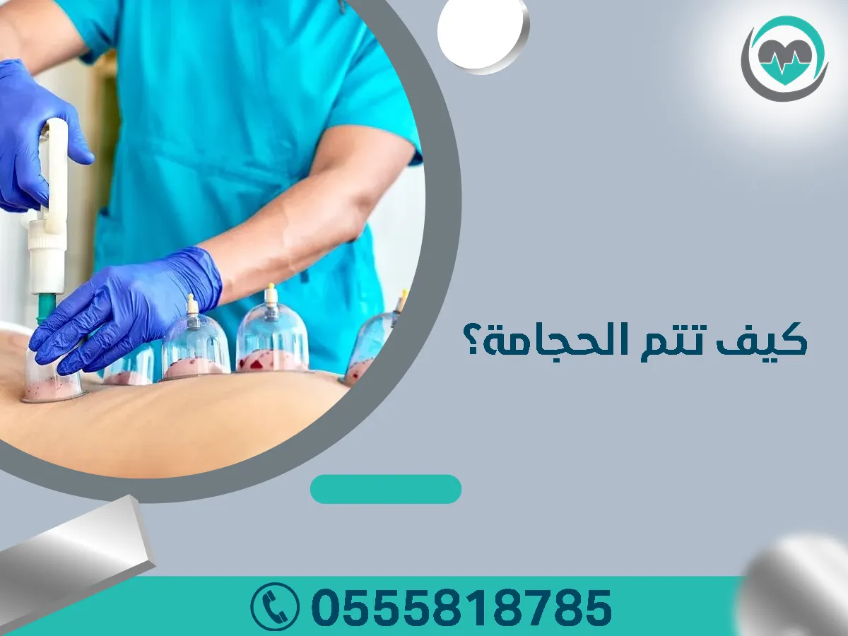 أهم الأمراض التي تعالج بالحجامة