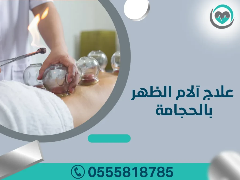 علاج آلام الظهر بالحجامة
