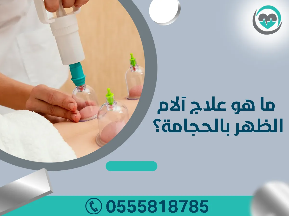 علاج آلام الظهر بالحجامة