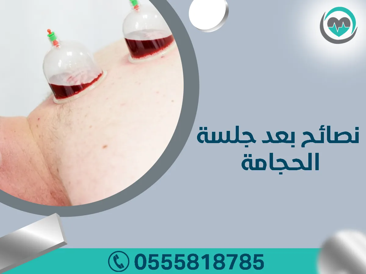 علاج آلام الظهر بالحجامة