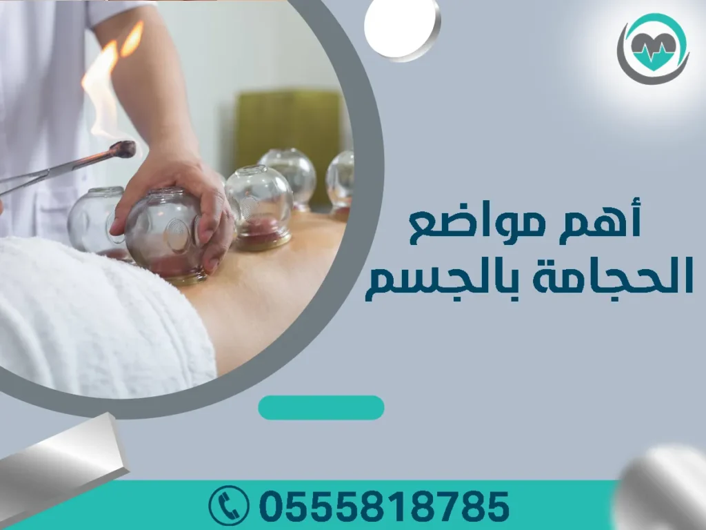 أهم مواضع الحجامة بالجسم
