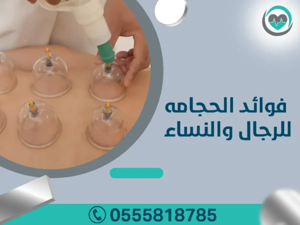 فوائد الحجامة للرجال والنساء