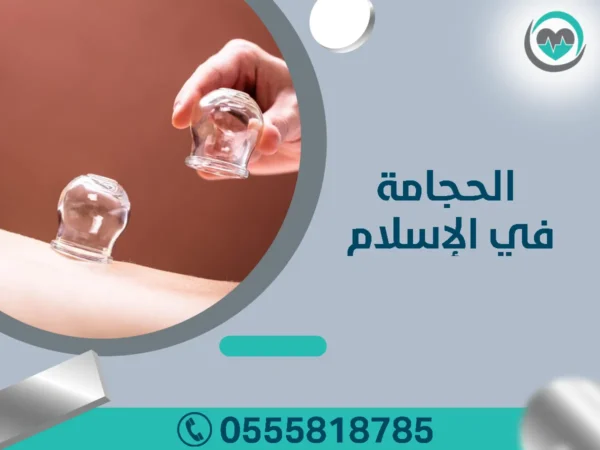 الحجامة في الإسلام