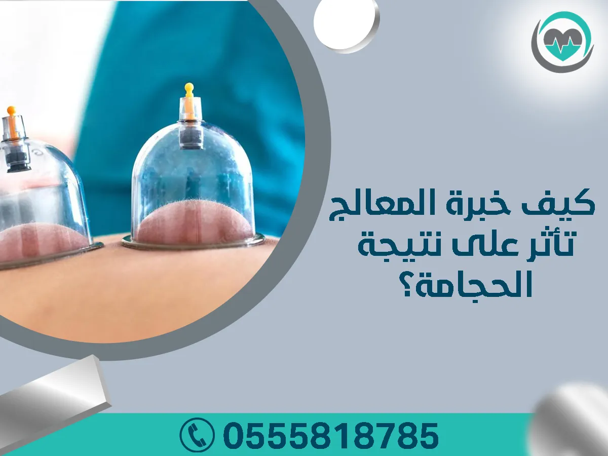 كيف خبرة المعالج تأثر على نتيجة الحجامة؟ مركز خبراء الحجامة