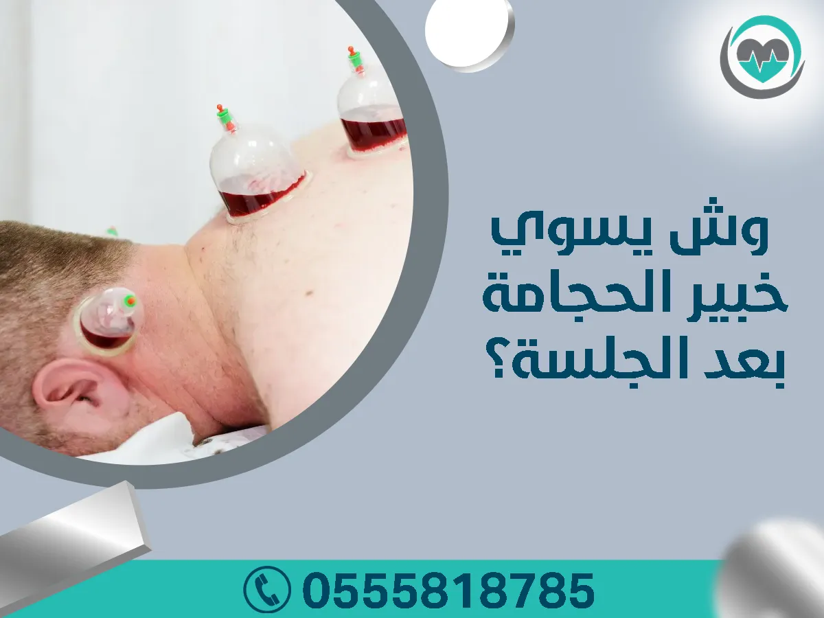 وش يسوي خبير الحجامة بعد الجلسة؟ خبراء الحجامة