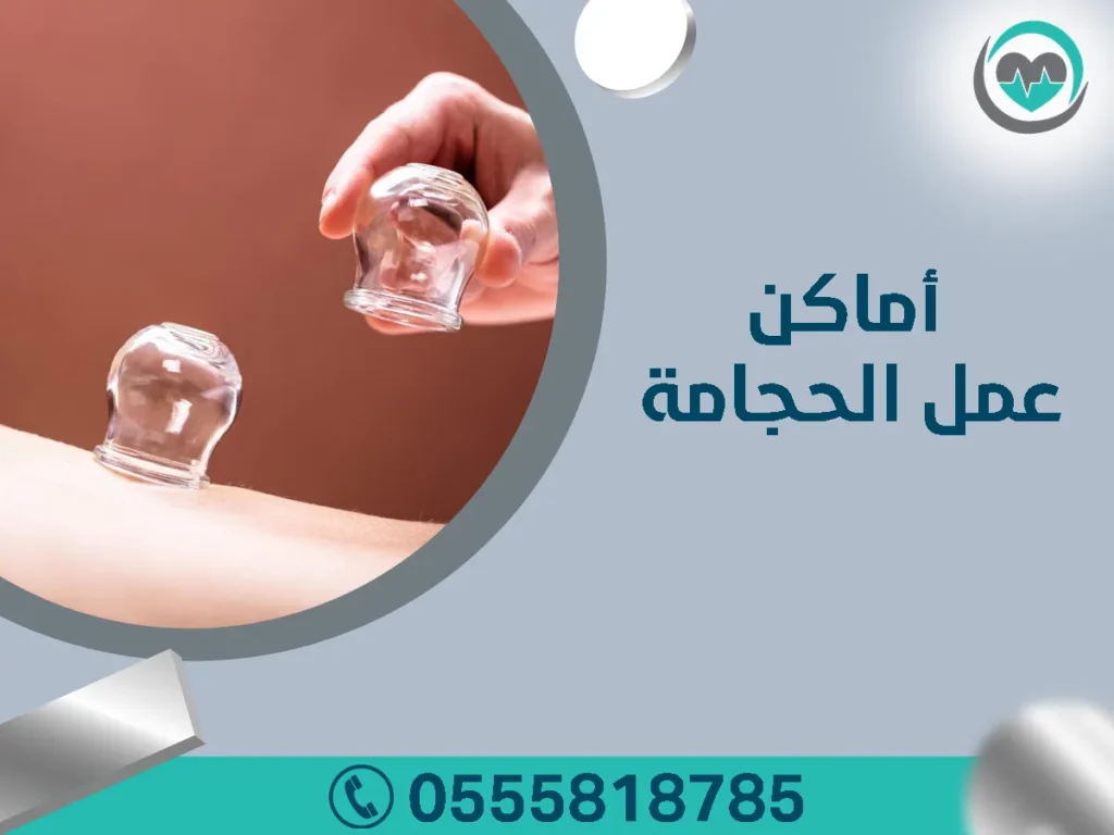 أماكن عمل الحجامة