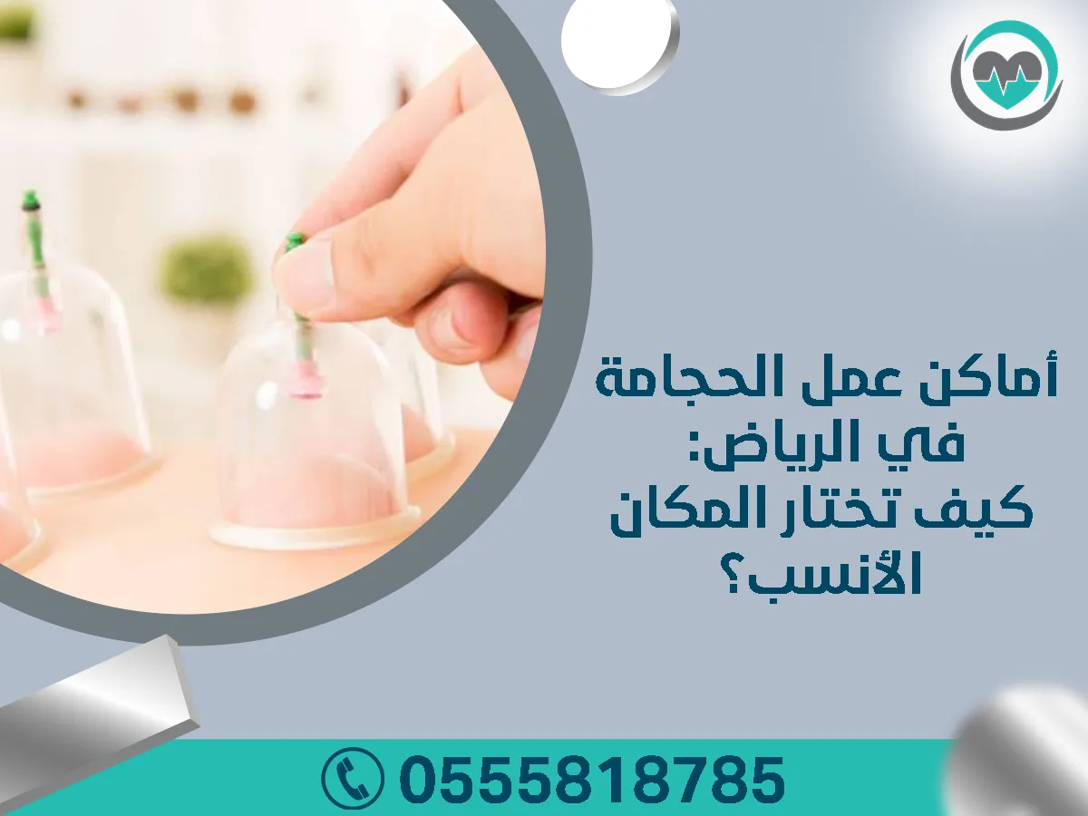 أماكن عمل الحجامة في الرياض: كيف تختار المكان الأنسب؟