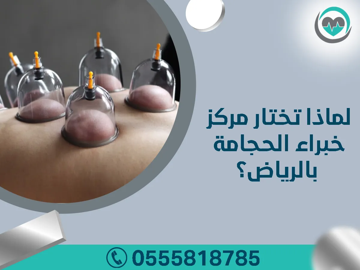 لماذا تختار مركز خبراء الحجامة