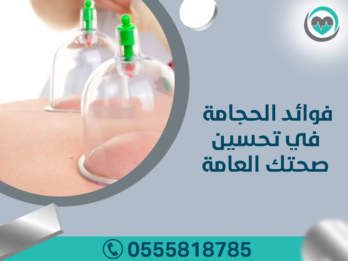 فوائد الحجامة في تحسين صحتك