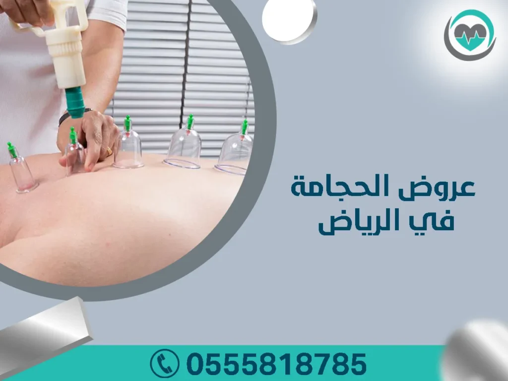 عروض الحجامة في الرياض