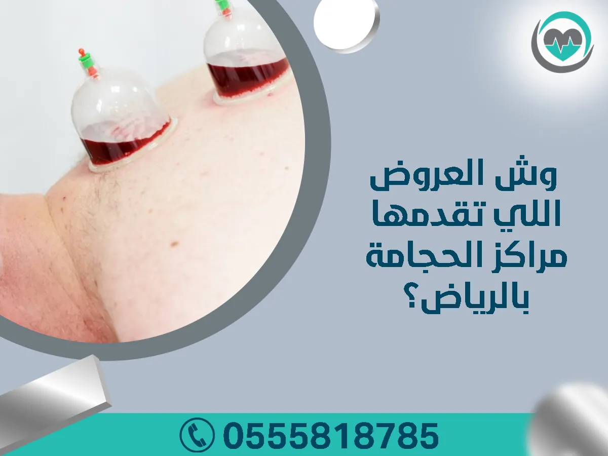 وش العروض اللي تقدمها مراكز الحجامة