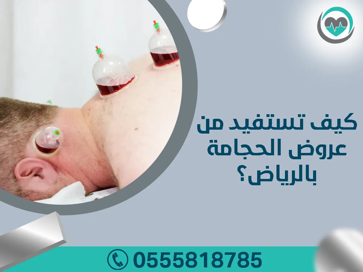 كيف تستفيد من عروض الحجامة