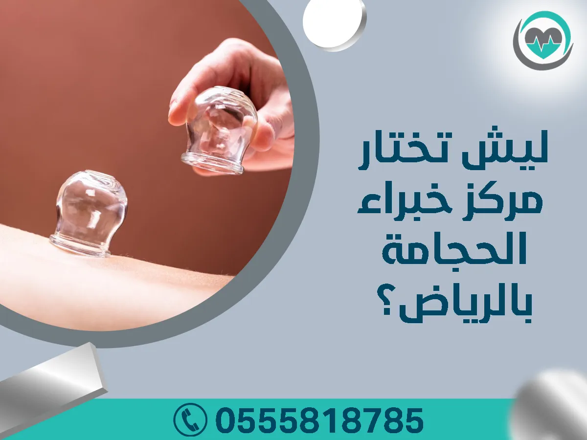 ليش تختار مركز خبراء الحجامة