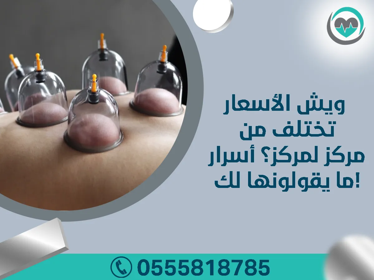 ويش الأسعار تختلف من مركز لمركز؟