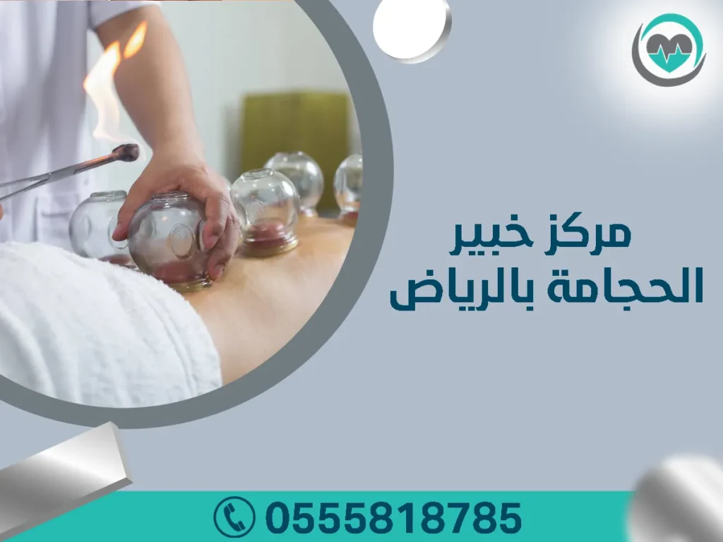 مركز خبير الحجامة بالرياض