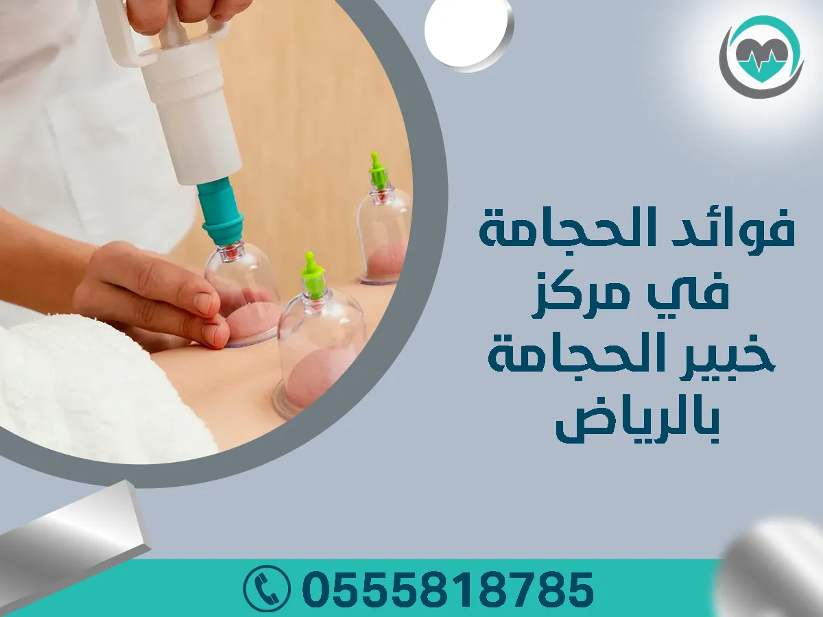 مركز خبير الحجامة بالرياض