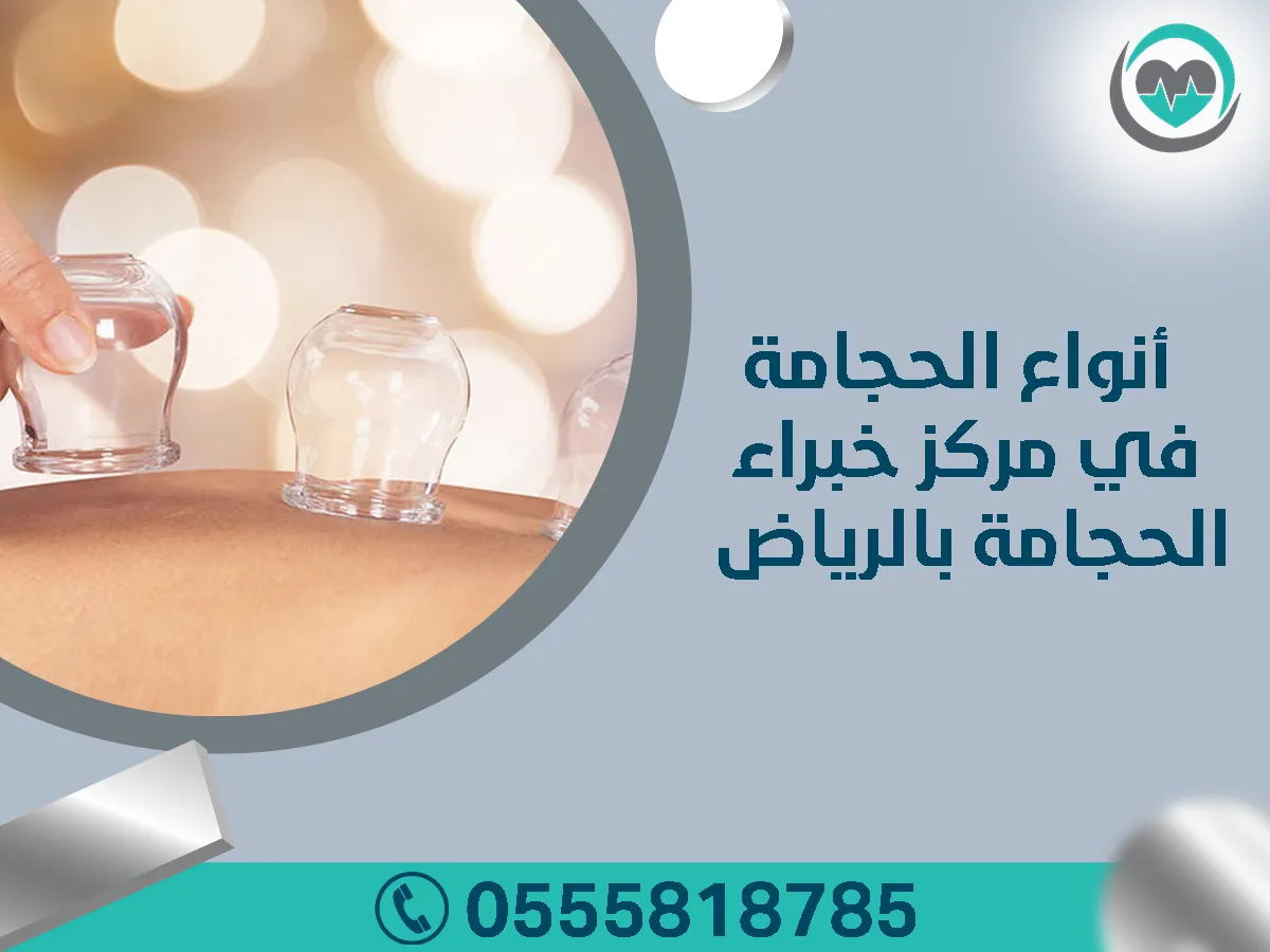 فوائد الحجامة في مركز خبير الحجامة بالرياض