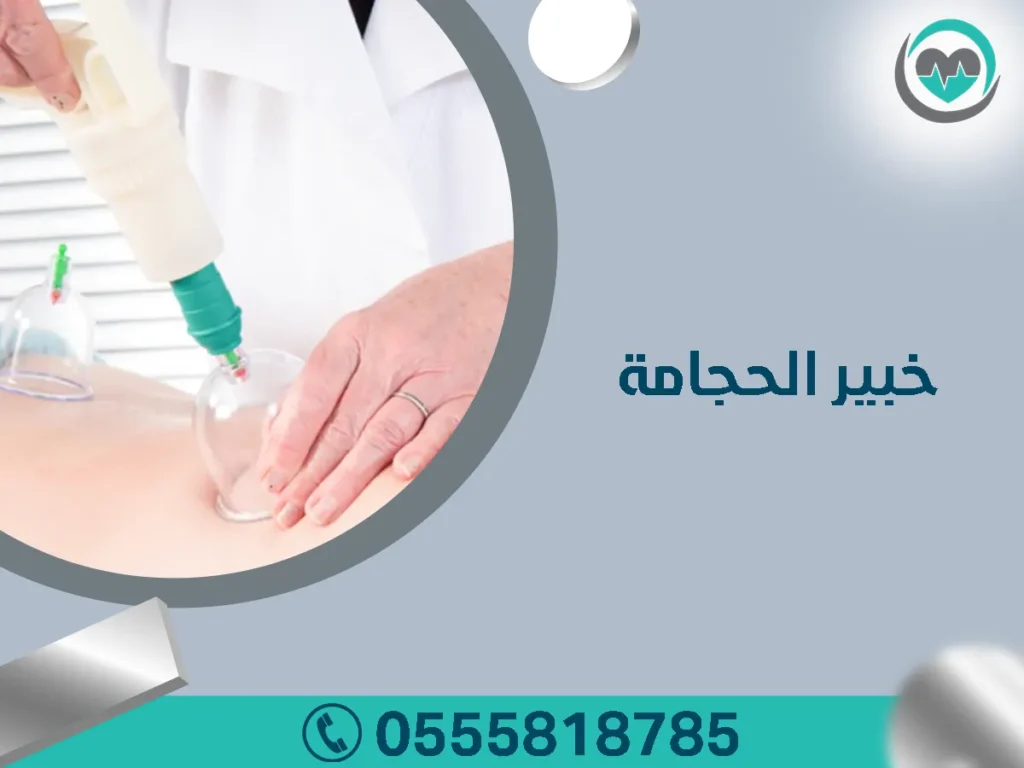 خبير الحجامة